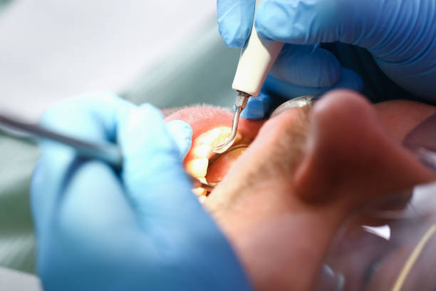 Best Emergency Denture Repair in Timmonsville, SC