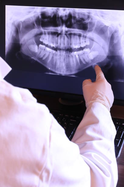 Best Emergency Dental Care for Broken or Chipped Teeth in Timmonsville, SC